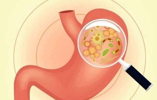 感染幽门螺旋杆菌能看好吗