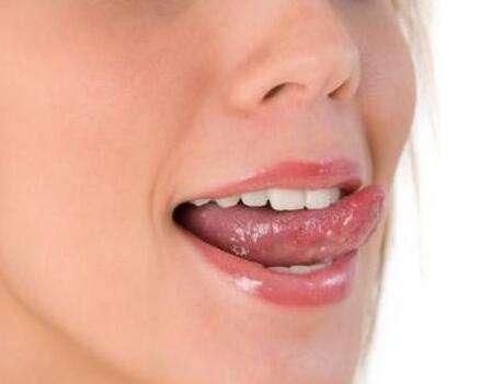 口腔科医生:为什么你的舌头颜色是黑的?