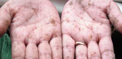 世界上最毒的物质 钋210毒性可怕