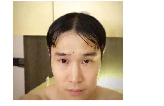 男神留中分,鹿晗呆萌可爱吴亦凡如漫画走出来,只有最后一位亮瞎大家地眼睛啦 小沈阳自晒中分发型并自夸挡不住的颜值,有着很高自信是让人佩服的地方,不过小沈阳还是真的驾驭不住这种中分的发型。你们觉得谁最帅呢?