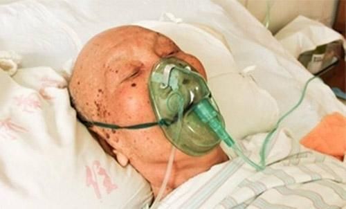 肺气肿的诱因、症状与预防方法,附:治疗肺气肿