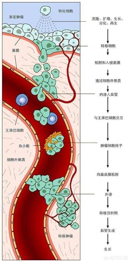 知道肺癌分期才知道哪些肺癌可以根治，这里有通俗易懂的分期知识