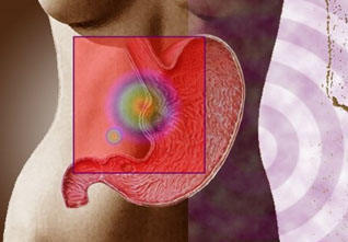 这样的便便,警惕是胃癌、直肠癌的早期信号!