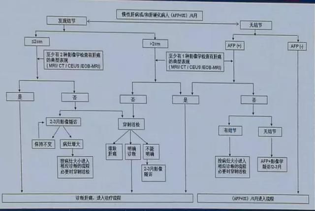 全面解读2017版原发性肝癌诊疗规范