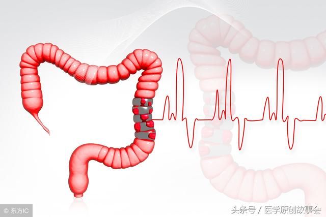 肚子经常咕咕叫会是大肠癌吗,医生说最常见的