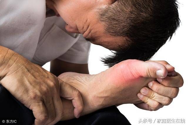 营养师:春节期间多吃这些食物，尿酸只降不升!