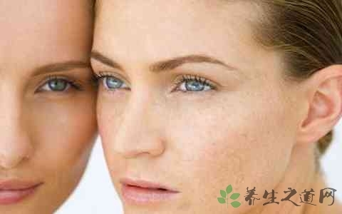 手上长老年斑是怎么回事_【快资讯】