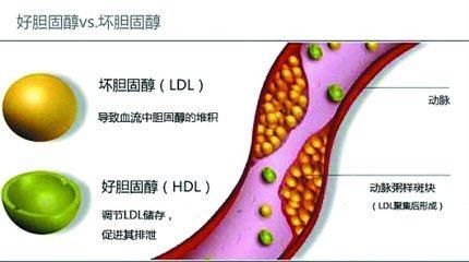 你一直想知道，关于胆固醇的一切