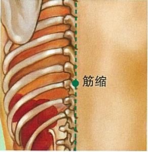 筋缩穴:善治筋脉拘挛