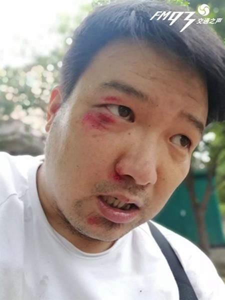 朋友圈无需点赞