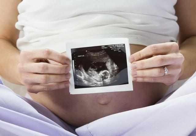 怀孕3个月B超却显示腹中无胎儿,医生却哈哈大
