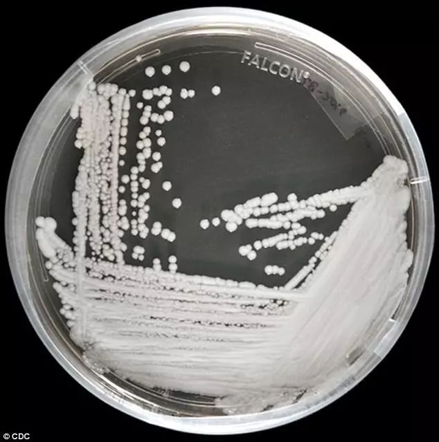 美国多地爆发超级真菌 近50%感染者90天内死