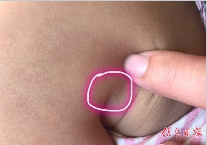 【信报调查】北京红黄蓝幼儿园被指虐童 多名