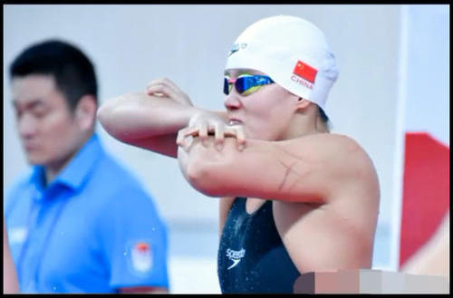 傅园慧得冠军反被喷,赛前胳膊惊现恐怖抓痕,网