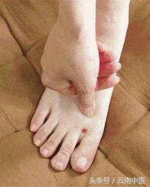 “肝郁”和“脾虚\＂解决好，瘦成闪电在分毫