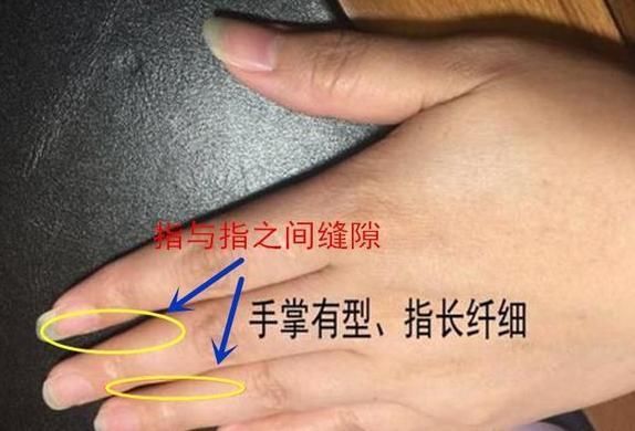 手相:女字纹，岛子纹，断掌等纹路，有何意义?你占了几条?