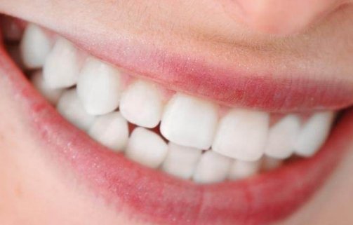 牙齿种植的费用