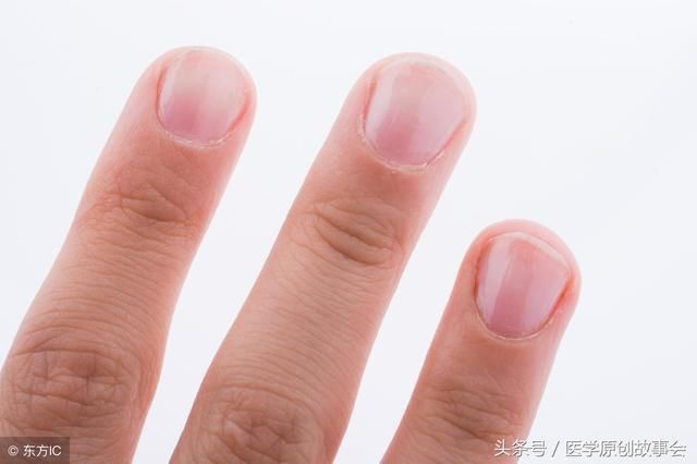 指甲改变提示了哪些疾病,经常美甲对健康有利