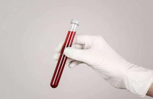 健康普及:五十岁体检需要检查哪些项目?看完你