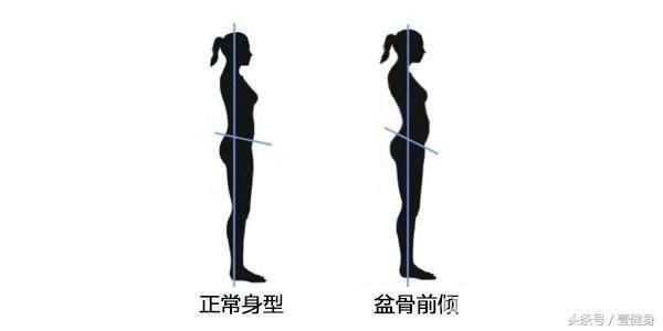 含胸驼背对身体有什么影响?看完你还敢坐姿不