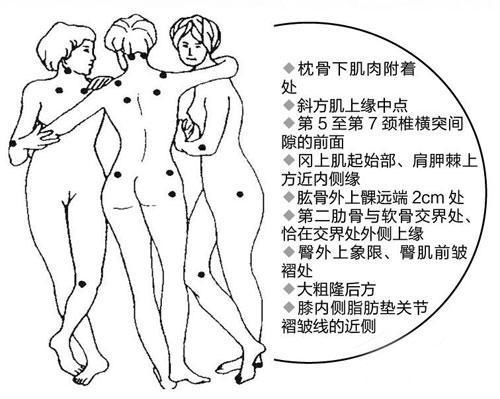 Ladygaga因这种病取消巡演,20岁~60岁女性都可能得病!