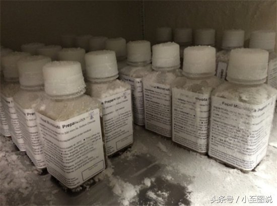 十个最恶心却昂贵的东西,擦鼻涕的卫生纸卖到