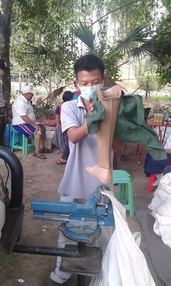 缅甸一镇区康复中心为大量残疾人免费安装义肢
