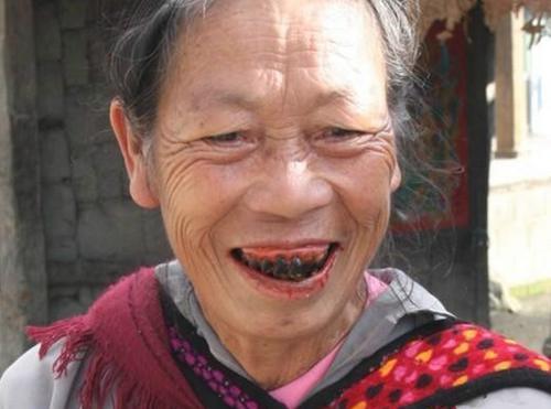 每天嚼一包槟榔,连续吃10年,身体最后会发生什