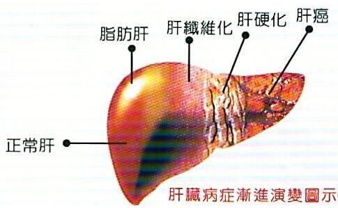 玫瑰花加它泡水喝，养肝消脂美颜，喝走脂肪肝！