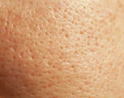 化妆品含有哪些成分会引发化妆品皮炎?