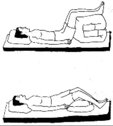 什么样的睡姿可以改善腰间盘突出、腰腿痛?