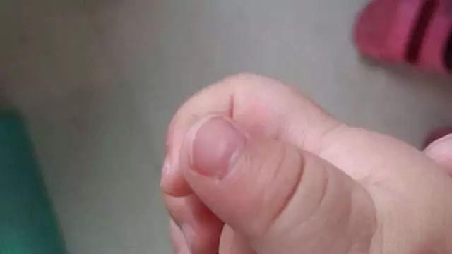 辟谣!网上疯传的8个宝宝缺钙的症状是真的吗?