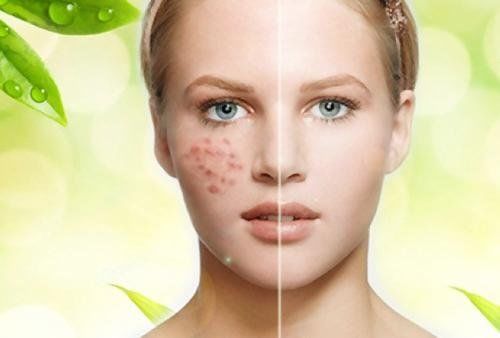 皮肤科医生:研究发现98%脸上都会有感染面部
