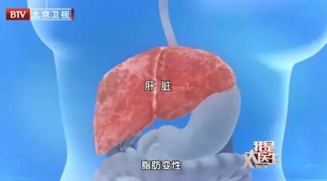 多位知名人士死于肝癌，我们应该如何预防？