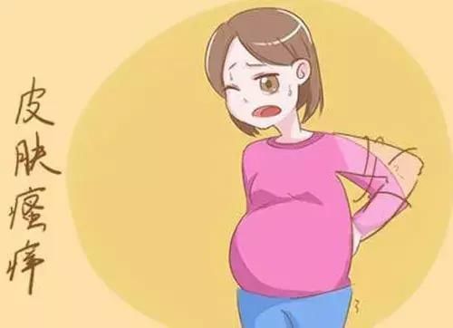 孕晚期皮肤瘙痒?有可能是妊娠期肝内胆汁淤积