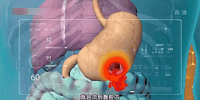 脾胃差百病生!照这方法吃,健脾养胃补气血,脸色越来越好!