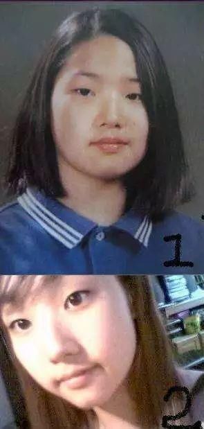 和baby一样换头却像高圆圆一样自然,整容只服