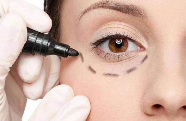 去眼袋整容医院