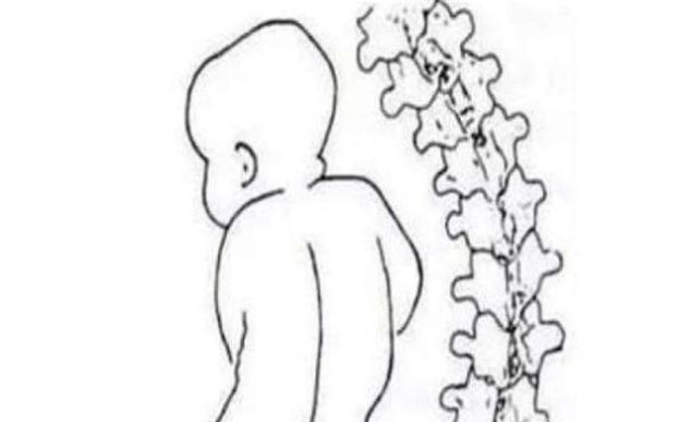 「孕婴知识」宝宝过早站立到底有哪些危害,宝