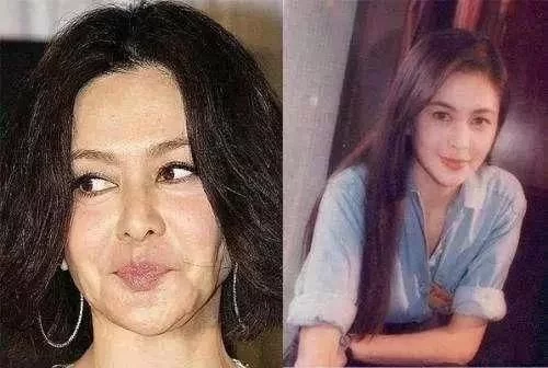因整容而毁容吓人的明星,因整容而毁容吓人的明星有哪些