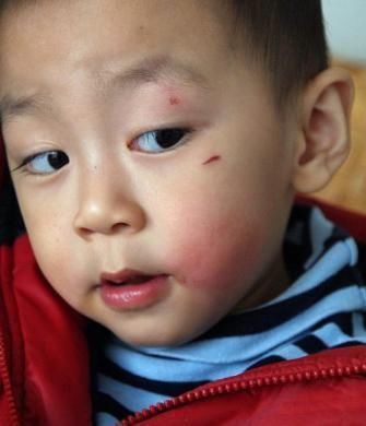 6岁男孩嗜睡昏迷,都怪奶奶太惯着,一样东西连