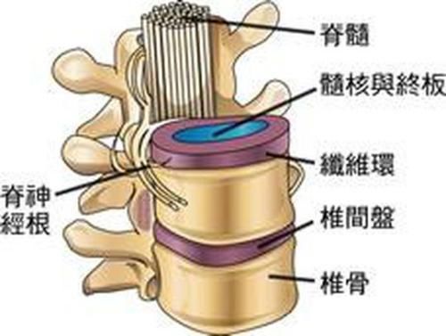患有腰突症!专家推荐3个方法,快速帮你缓解腰疼腿疼!