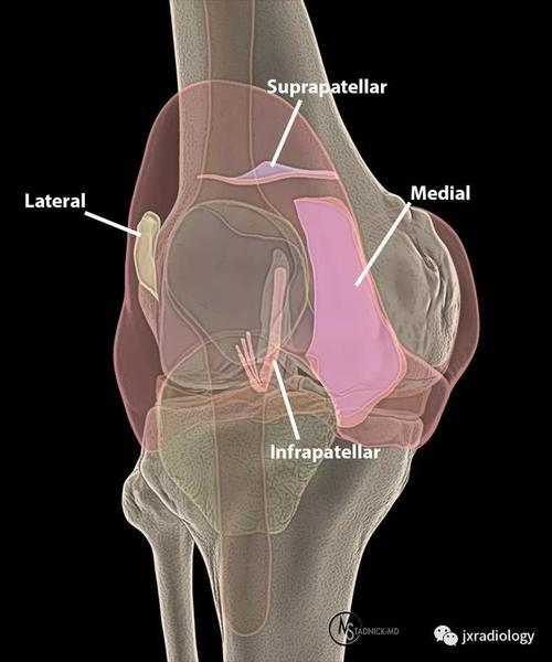 髌内侧滑膜皱襞综合征