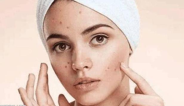 螨虫号称皮肤田鼠,脸上到底有没有,对照4道螨