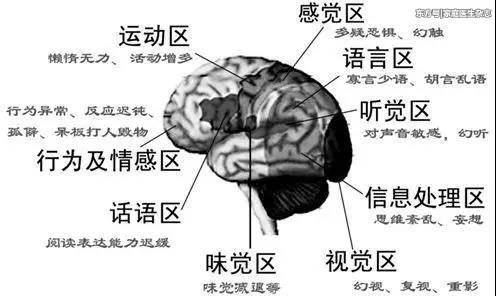 睡觉鬼压床，真是鬼上身？科学揭秘这种诡异体验……