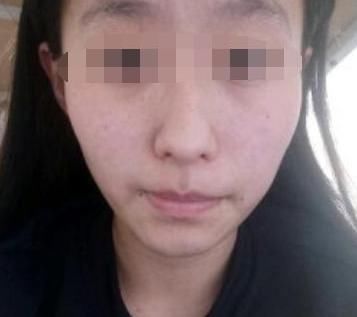 额头有这种特征的人,生来穷苦相,怕是很难有出头之日!