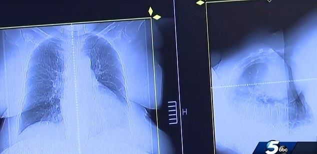 每日邮报报道:男子用狗药治疗肿瘤的故事