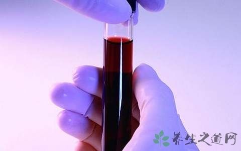 哪些情况下要进行梅毒检查