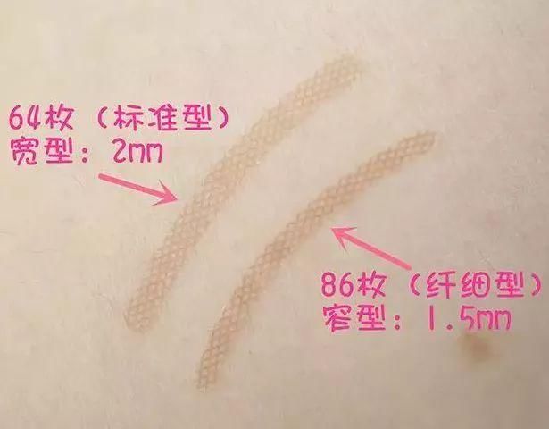 明星这么有钱双眼皮还割这么烂,普通人可怎么