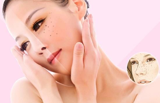 皮肤美容宋丽秋:光子祛斑和激光祛斑的区别是